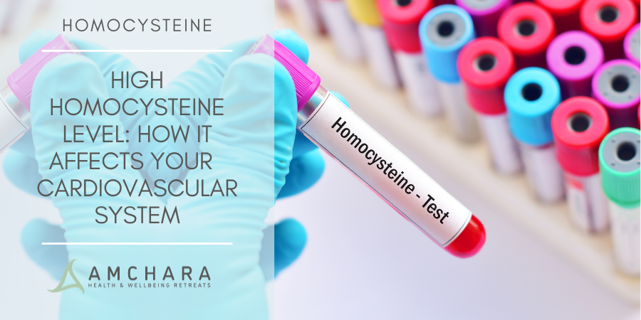 High Homocysteine Level How It Affects Your Cardiovascular System